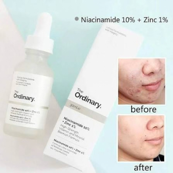 Ordinary Niacinamide Serum - TabletStore.Pk