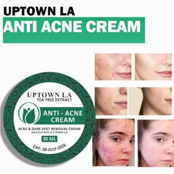 Uptown La Anti Acne Cream – TabletStore.Pk